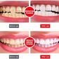 Yayashi Sp-4 Ultra Whitening Toothpaste