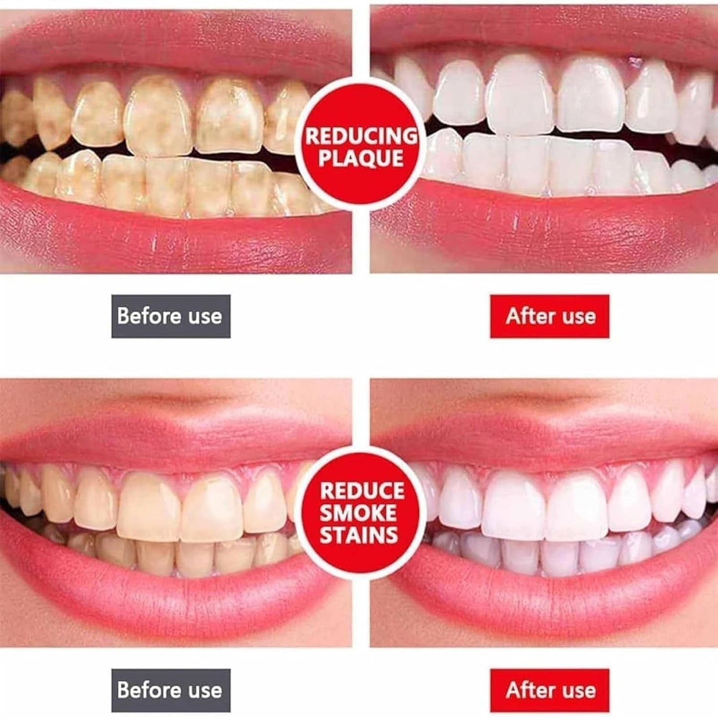 Yayashi Sp-4 Ultra Whitening Toothpaste